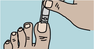 Graphic depiction of clipping toenails.